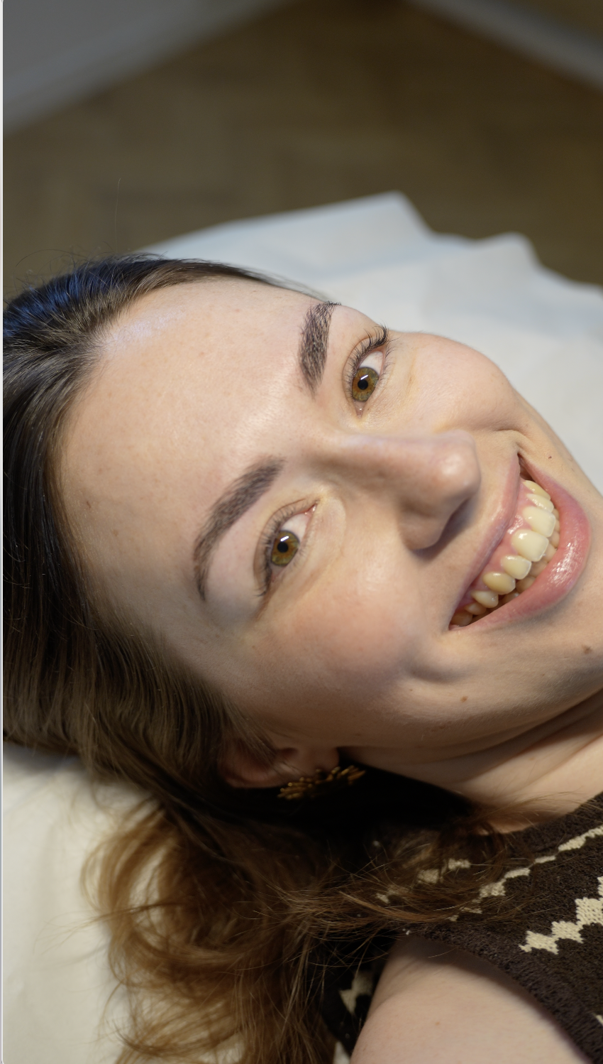 Harmonie Concept - Browlift